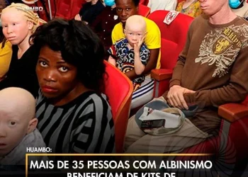 Mais de 35 pessoas com albinismo beneficiam de kits de protecção solar